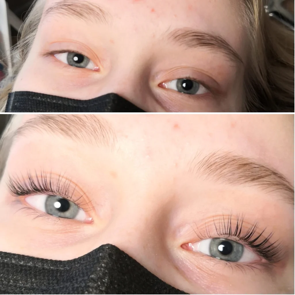 Aakoo Lashlift